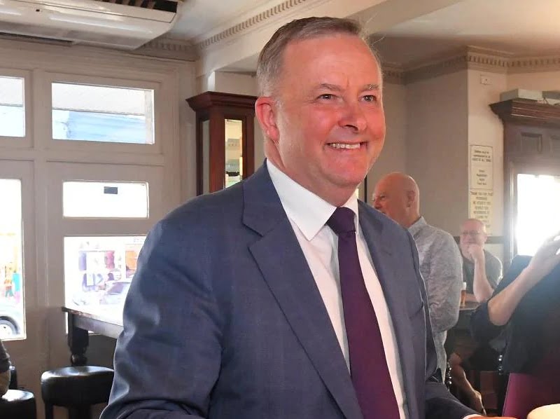 Anthony ALbanese